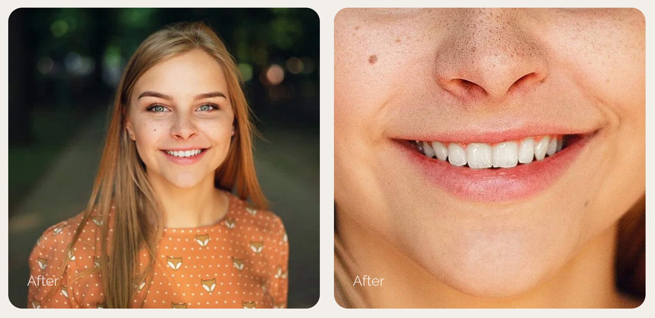 Retouch4me White Teeth screenshot 3